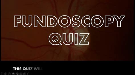 fundoscopy quiz.
